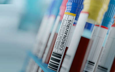 Compliance Alert: IRS Announces that HDHPs Can Cover Coronavirus Testing at No Cost with No Effect on HSA-Eligibility